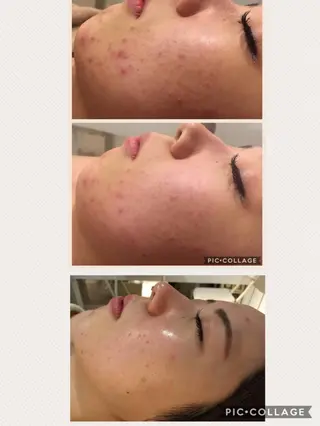 ミディアム カラー パーマ ヘアアレンジ メンズ キッズ ネイル マツエク・マツパ 四つ星サロン🎖 腸＆ニキビケアに特化のエステ・リラクイメージ