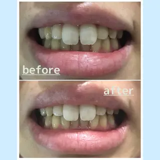 お手軽ホワイトニングsalon mina所属・武元 奈津美のその他イメージ