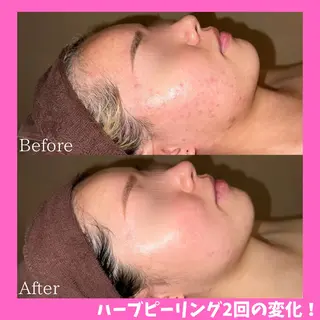 痩身&美肌サロン 堀米✨のその他イメージ