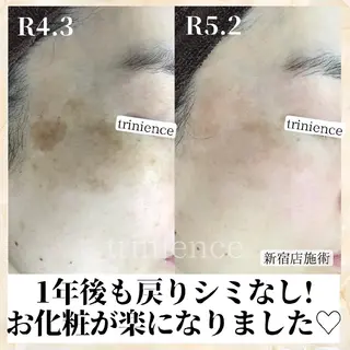 シミケア・肌改善専門 トリニエンス浦和店のエステ・リラクイメージ