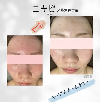 ハーブ蒸しサロン🌿 香嬉琉🌿きよかのエステ・リラクイメージ