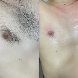 六本木脱毛andS 店長Sachiのエステ・リラクイメージ