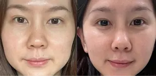 マツエク・マツパ aliaハイフ&水光ジェットサロン所属・aliaハーブ水光店 エステティシャン募集のエステ・リラクイメージ