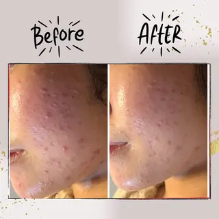 ピーリング専門店 Belluteのエステ・リラクイメージ