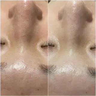 ✨美肌水光✨ アトリエリュバンのエステ・リラクイメージ