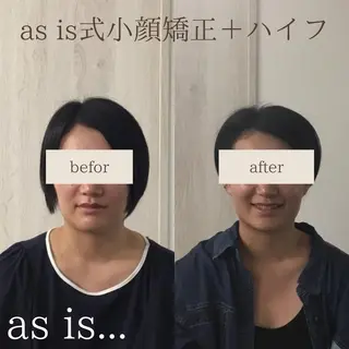 小顔専門アズイズ ビューティー　草津店のエステ・リラクイメージ