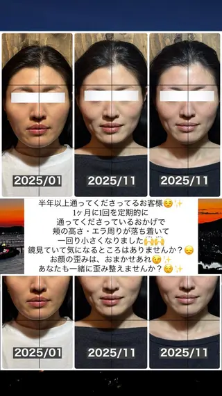 💎後悔させない小顔 矯正💎イトヤマ🌱のエステ・リラクイメージ