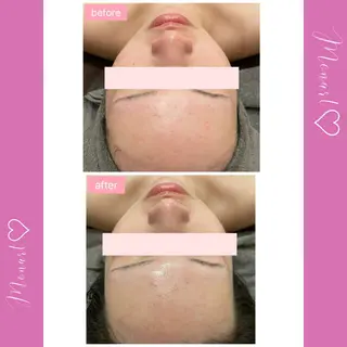 Monart -deux-のエステ・リラクイメージ