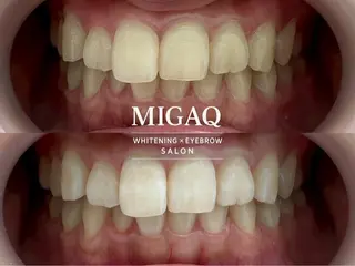 歯のホワイトニング専門店 MIGAQ 京都四条大宮店所属・佐藤 未来のその他イメージ