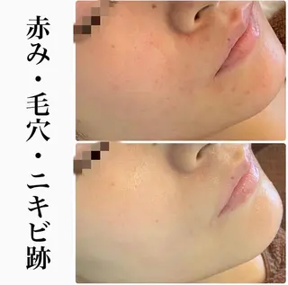 ハーブピーリング専門 BIOEL横浜のエステ・リラクイメージ