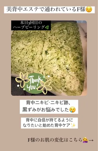 ベラージュ【美背中・ 美尻・フェイシャル】のエステ・リラクイメージ