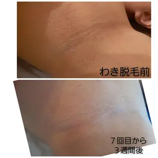 Lemon grassのエステ・リラクイメージ