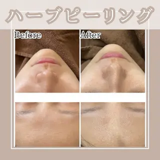 メンズ キッズ Amaryllis 🌹松本のエステ・リラクイメージ