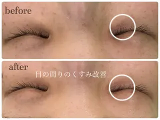 デ・アイム新潟北所属・サイトウ .のエステ・リラクイメージ