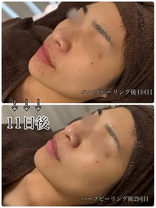 リンパケアサロン 🧡Relairのエステ・リラクイメージ