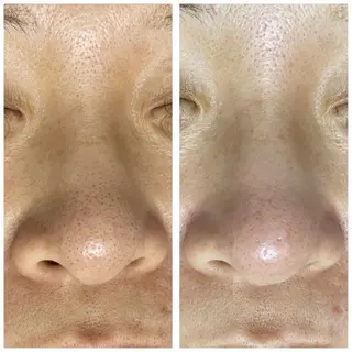 Beauty Salon MARE所属・ビューティーサロン MAREのエステ・リラクイメージ