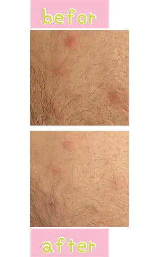 癒し腸もみサロン シャユーム　ゆきなのエステ・リラクイメージ