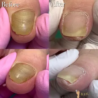 ネイル 東京巻き爪アカデミー所属・東京巻き爪 アカデミーのエステ・リラクイメージ