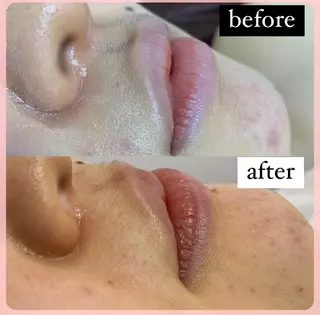 メンズ キッズ 脱毛SALON RaYNiCKのエステ・リラクイメージ