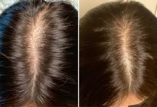 40代からの髪悩み 専門美髪アドバイザーのヘアスタイル
