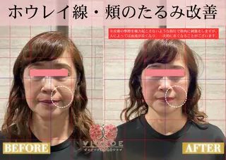 ヴィオーデ美容整体 サロン　錦糸町店のエステ・リラクイメージ