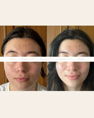 痩身/腸もみ/ ヘッドスパ/リンパのエステ・リラクイメージ