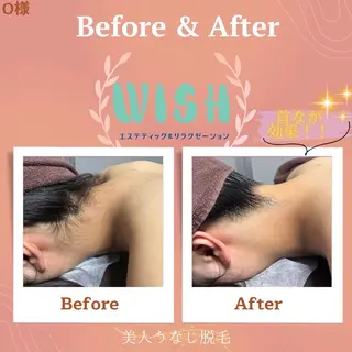WISH 美肌脱毛のプロ！須藤のエステ・リラクイメージ