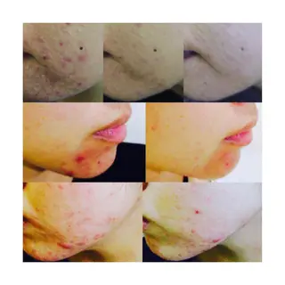 菊地 恵美のエステ・リラクイメージ