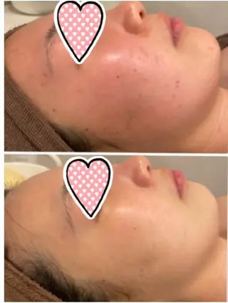 美テラス サロンのエステ・リラクイメージ