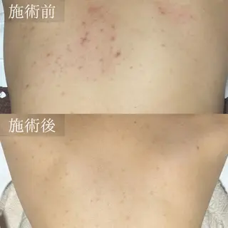 エステサロン WABISABI所属・【美肌・脱毛専門店】 博多WABISABIのエステ・リラクイメージ