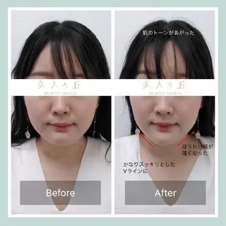 韓国/ヌーディー系 ネイル自由が丘のネイルデザイン