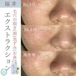 毛穴ケア専門サロン Yourmeユアミーのエステ・リラクイメージ