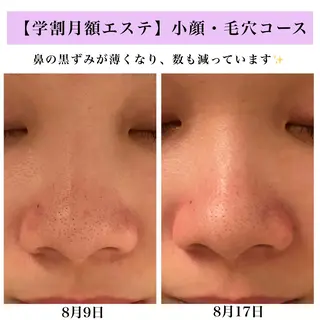 Bellesthe (ベルエステ)のエステ・リラクイメージ