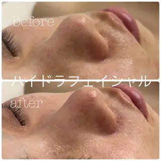 フェイシャルサロン CHIARA 荒田のエステ・リラクイメージ