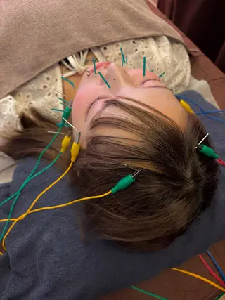 かりの スターズ鍼灸整骨院のエステ・リラクイメージ