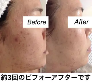 ネイル マツエク・マツパ 都度払い肌質改善 &脱毛Blancheのエステ・リラクイメージ