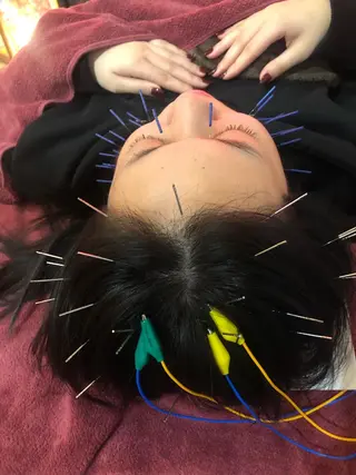 美容鍼灸女性専用 りんご鍼灸治療院のその他イメージ
