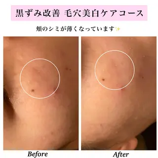 Bellesthe (ベルエステ)のエステ・リラクイメージ