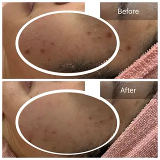 【現役看護師】高来 笑子のエステ・リラクイメージ