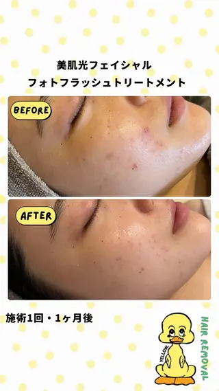 yellow.所属・yellow💛【 脱毛&フェイシャル】のエステ・リラクイメージ