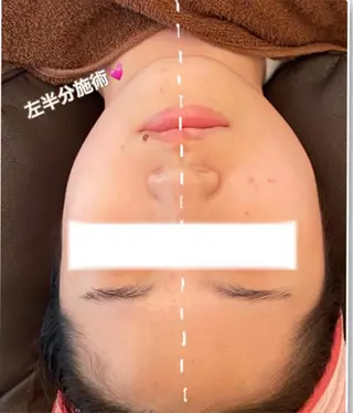 FLEUR大阪・整体 ・ハイフ・痩身・小顔のエステ・リラクイメージ