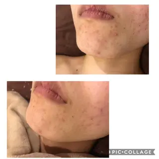 セミロング カラー パーマ ヘアアレンジ メンズ キッズ ネイル マツエク・マツパ 四つ星サロン🎖 腸＆ニキビケアに特化のエステ・リラクイメージ