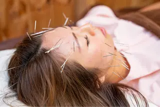 小顔ハーブピーリング 美容鍼/毛穴洗浄のエステ・リラクイメージ