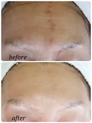 リンパケアサロン 🧡Relairのエステ・リラクイメージ