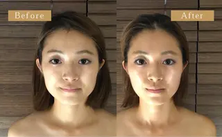 小顔・耳つぼ/ CHISATOのエステ・リラクイメージ