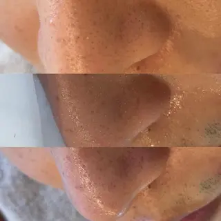 メンズ アイブロウ Amm所属・🏆艶肌ワックス🏆 ララピール✨Ammのエステ・リラクイメージ