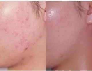 最速小顔・肌質管理 ❣️エスポワールのエステ・リラクイメージ