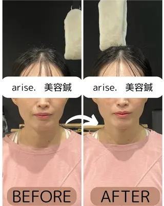 arise.所属・東広島美容鍼 /arise.のその他イメージ