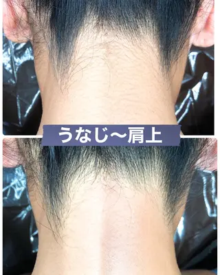 メンズ ブラジリアン☆WAX 🎖🌚YUKI🌚のエステ・リラクイメージ