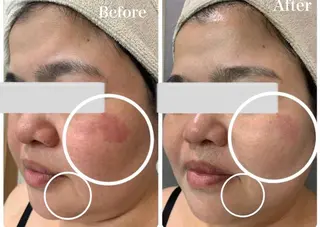 Lumiere despoir所属・Lumiere despoirのエステ・リラクイメージ